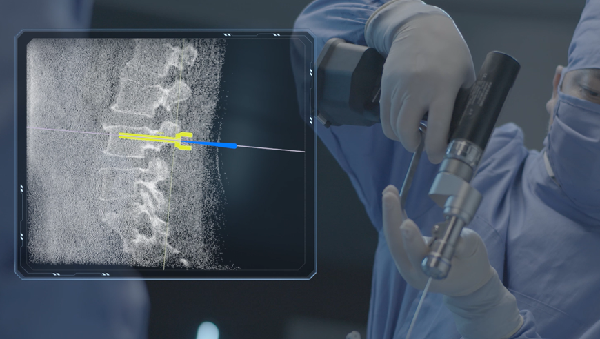 機器人做手術好還是醫生做手術好，機器人做手術有哪些好處？