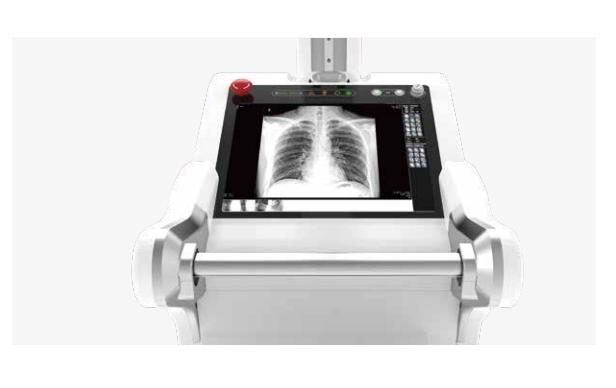 PLX5300移動(dòng)DR采用雙輪雙驅(qū)設(shè)計(jì) PLX5300移動(dòng)DR采用雙輪雙驅(qū)設(shè)計(jì)