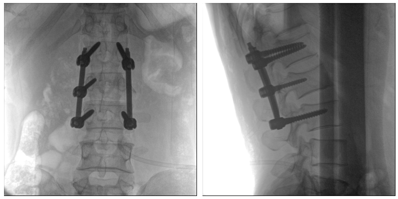 術中二維影像 術中二維影像