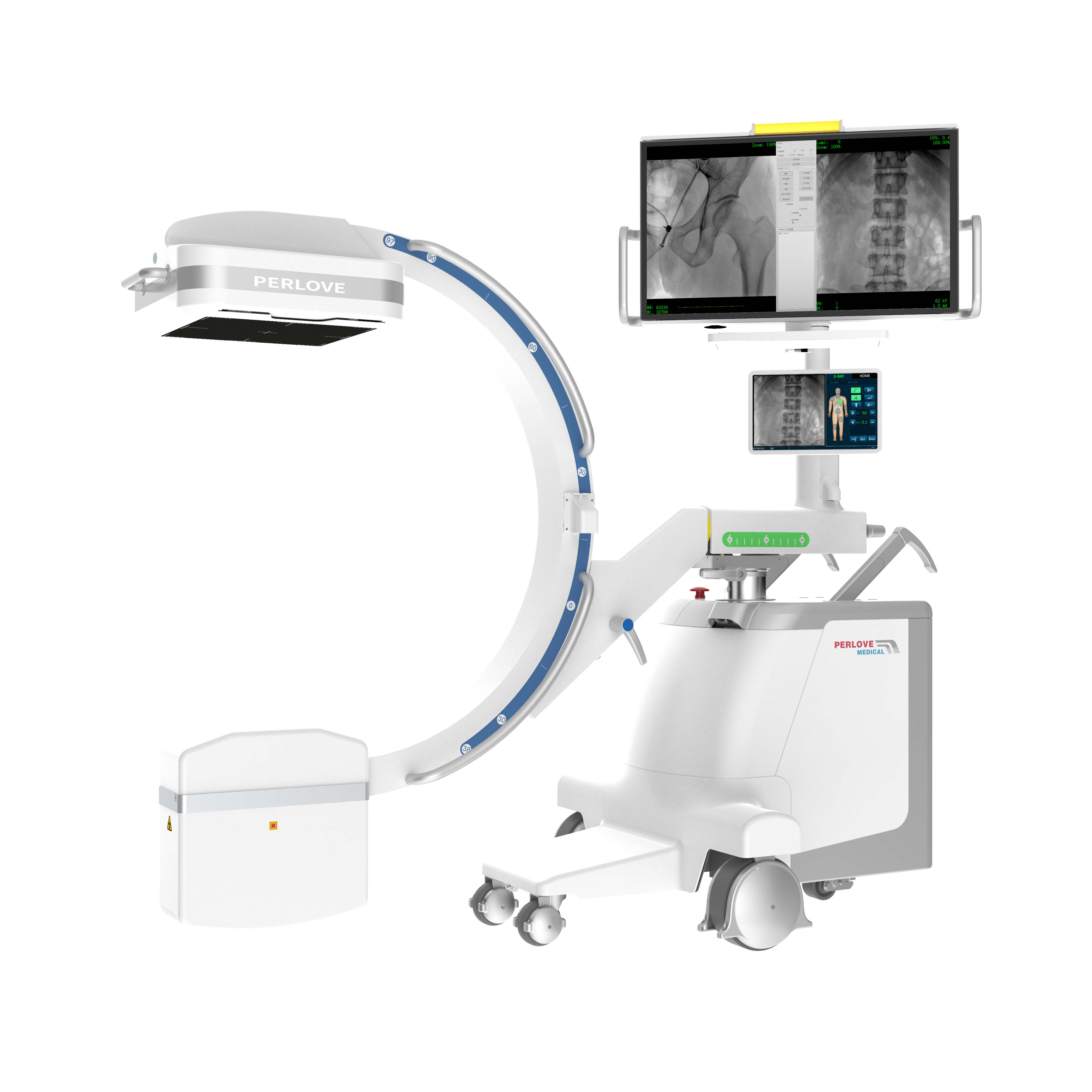 一體化大平板C形臂 一體化大平板C形臂