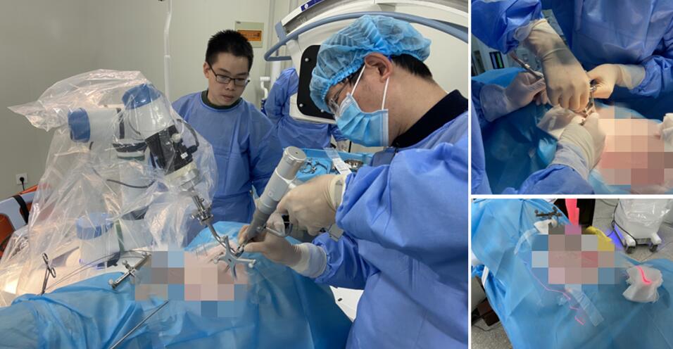 脊柱微創(chuàng)手術(shù)機(jī)器人-手術(shù)微創(chuàng)化 脊柱微創(chuàng)手術(shù)機(jī)器人-手術(shù)微創(chuàng)化