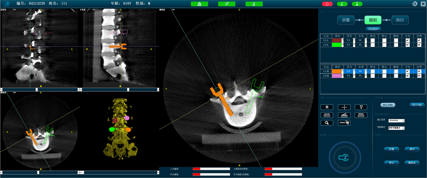 手術(shù)機(jī)器人 手術(shù)機(jī)器人