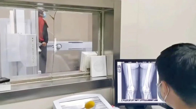 醫(yī)用DR檢查 醫(yī)用DR檢查