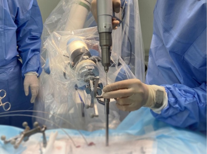 脊柱外科手術導航定位系統